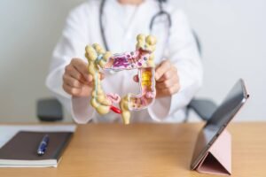 Cancro al colon: il microbioma può predire il rischio e guidare la diagnosi precoce