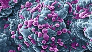 Tumore al seno: scoperta una 'firma pretumorale' in donne con mutazioni genetiche