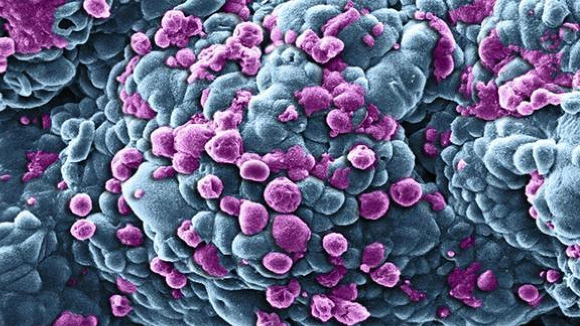 Tumore al seno: scoperta una 'firma pretumorale' in donne con mutazioni genetiche