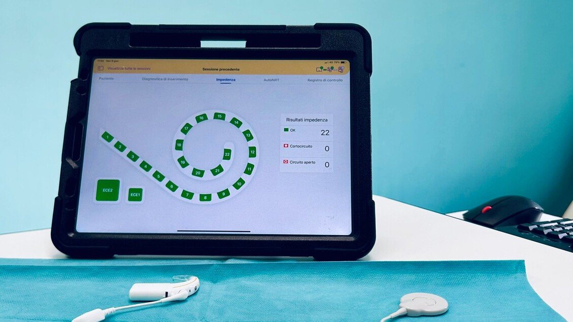 Al Policlinico di Bari impianto cocleare smart, un bambino di 11 anni recupera l'udito