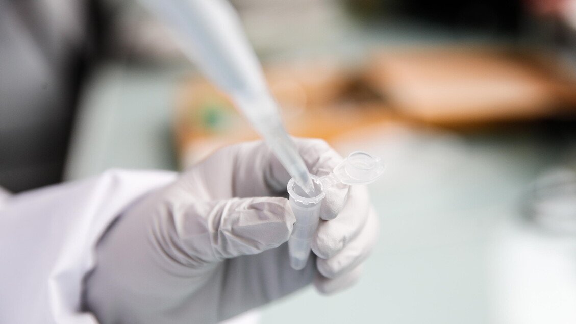 Tumore del testicolo: la biopsia liquida consente di selezionare le cure risolutive